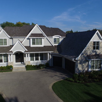Home Exterior Project - Deerfield IL