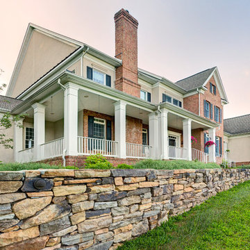 Dry-Stack Retaining Wall