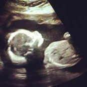 Fer Diaz de Leon's photo