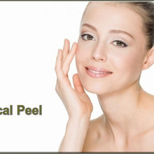 Chemical Peel Singapore