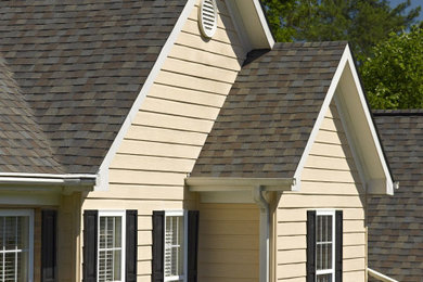 Shingles