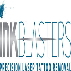 Ink Blasters Precision Laser Tattoo Removal