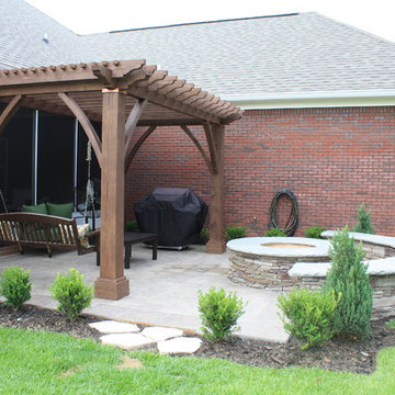 Woodburning Firepit Kit