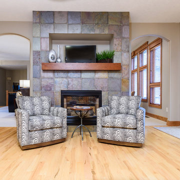From Traditional to Transitional Facelift