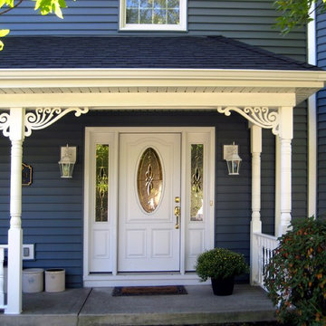 Porch brackets