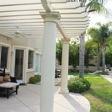 Patio Enclosure in Los Angeles