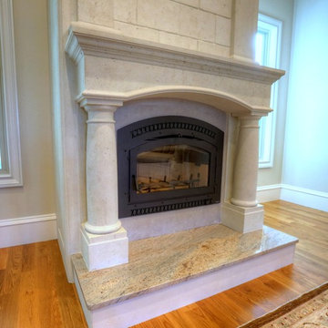 Stone Fireplace Mantels & Surrounds