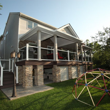 Exterior Remodel in Woodridge, IL