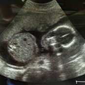 Foto von Elizabeth DeSloover