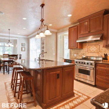 Serial Remodeler