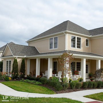LP SmartSide Lap Siding – 3