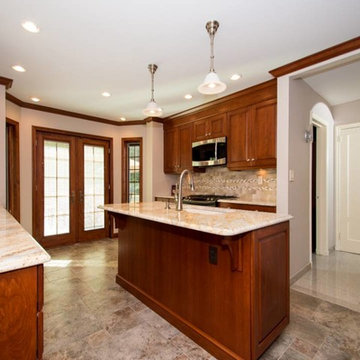 Kitchen Renovation extention in Manhasset, NY