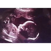 Emily Reiss's photo