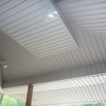 Siding