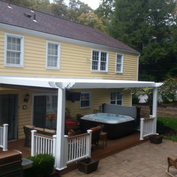 Arcadia Louvered Roofs for decks