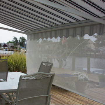 Motorized Retractable Awning