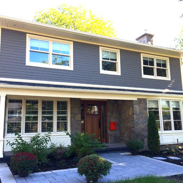 Complete face lift job in Pointe-Claire