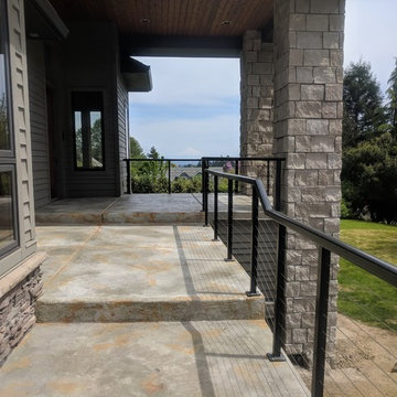 Lake Oswego Facelift