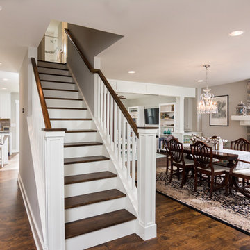Transitional Open Concept Full Home Remodel