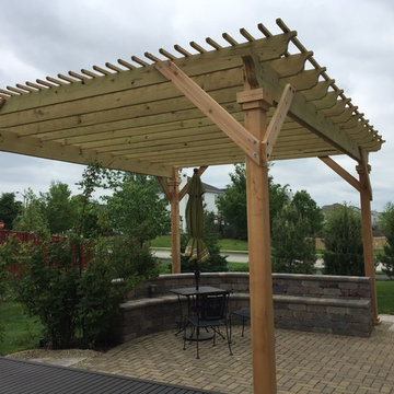 Detached Pergola by Elgin, IL Pergola Builder
