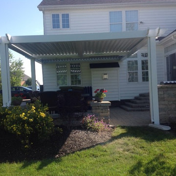Arcadia Louvered Roof: variety of installation types