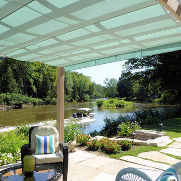 Retractable Shade, Wasaga Beach