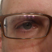 Edward Formans foto
