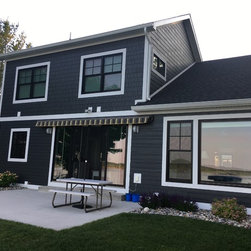 Retractable Awnings - Awnings