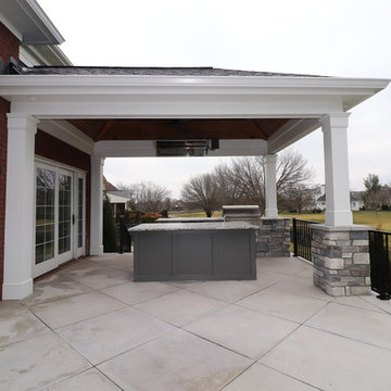 Lake Forest Outdoor Living Stone Patio with 2 Roof Structures
