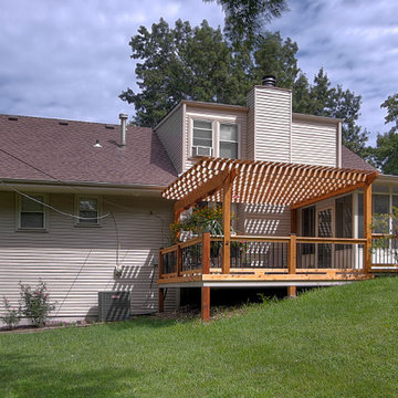 Pergola in Lenexa Ks