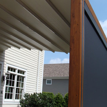 Private Residence, Northern NJ - Retractable Pergola Awning