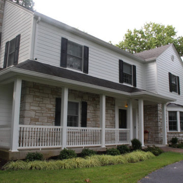 White LP Siding | Ladue, MO 63124