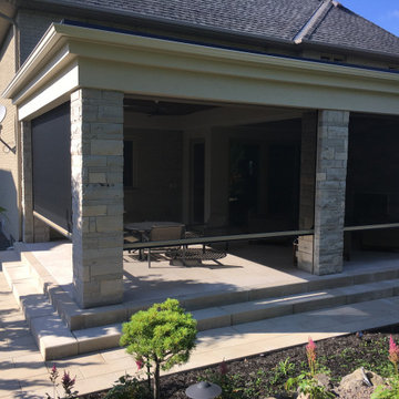 Retractable Screen Systems