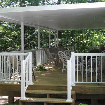 Patio Covers