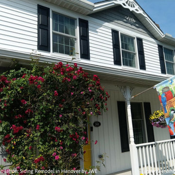 Exterior Remodel & Siding Installation in Hanover, PA 17331