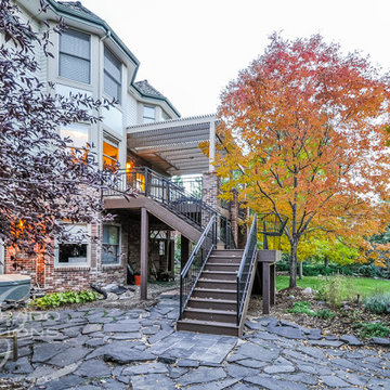 Englewood Pergola Deck with Split Stair Design