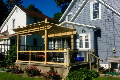Backyard Deck Addition