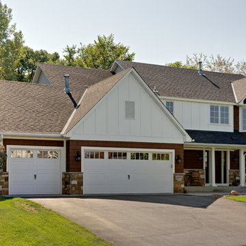 Exterior Facelift