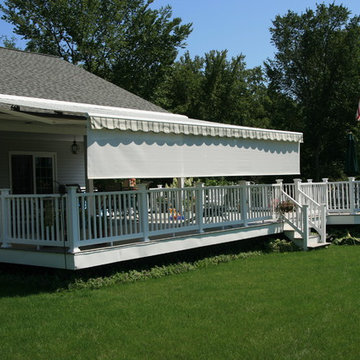 Residential Retractable Awnings