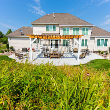 West Des Moines Custom Pergola