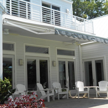 Motorized Retractable Awning