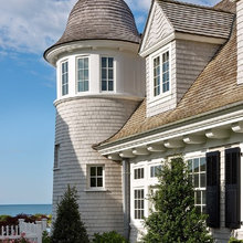 Shingles