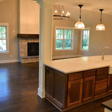 Whole Home Custom Remodel and Addition | Old Leawood