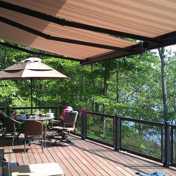 Motorized Retractable Awning