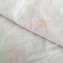 bright pink stains on washed clothes, help?
