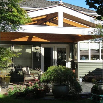 Patio Cover in Bothell, WA