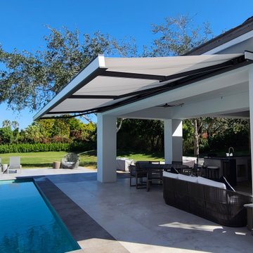 Luxury Retractable Awning