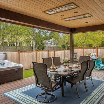 Sammamish Vaulted Outdoor Living