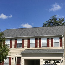 Shingles