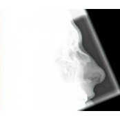 Yishai Friedlander's photo